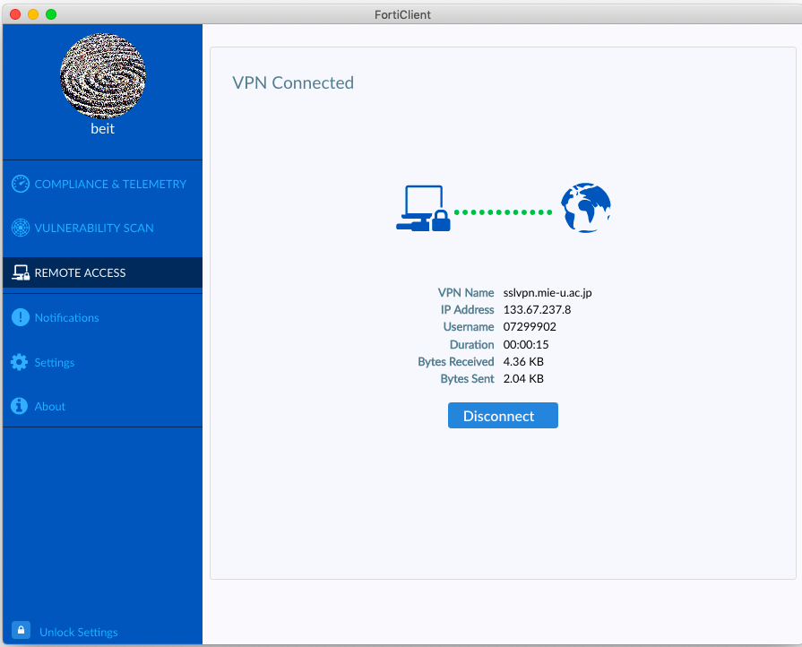 FORTICLIENT VPN. FORTICLIENT VPN ошибка 14. FORTICLIENT 7200 ошибка. Впн шаблон.